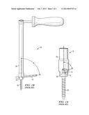 BAYONET COUNTER-TORQUE WRENCH diagram and image