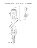 BAYONET COUNTER-TORQUE WRENCH diagram and image