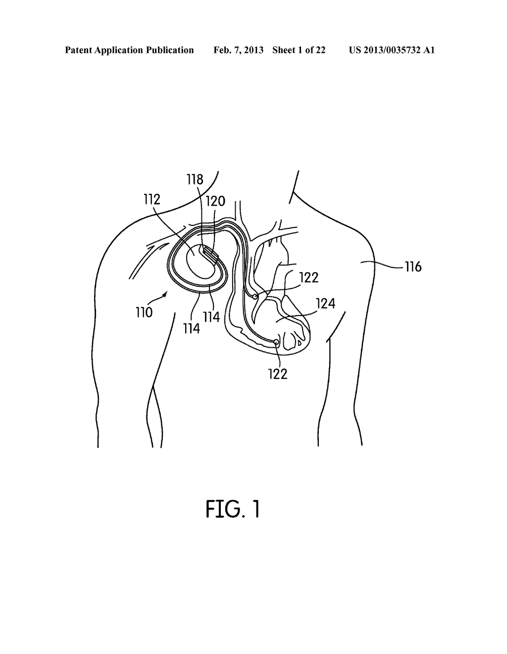 ELECTRICAL LEADS FOR A FEEDTHROUGH - diagram, schematic, and image 02