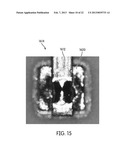 INTERCONNECTION OF CONDUCTOR TO FEEDTHROUGH diagram and image