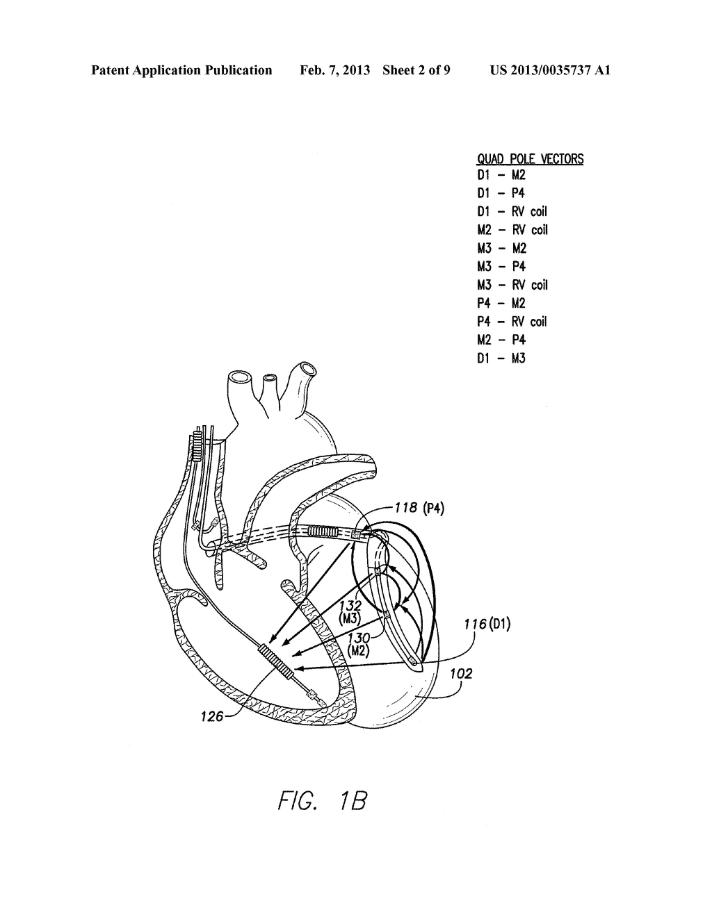 SYSTEMS AND METHODS FOR DETERMINING PACING RELATED PARAMETERS - diagram, schematic, and image 03