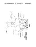 Device and Implantation System for Electrical Stimulation of Biological     Systems diagram and image