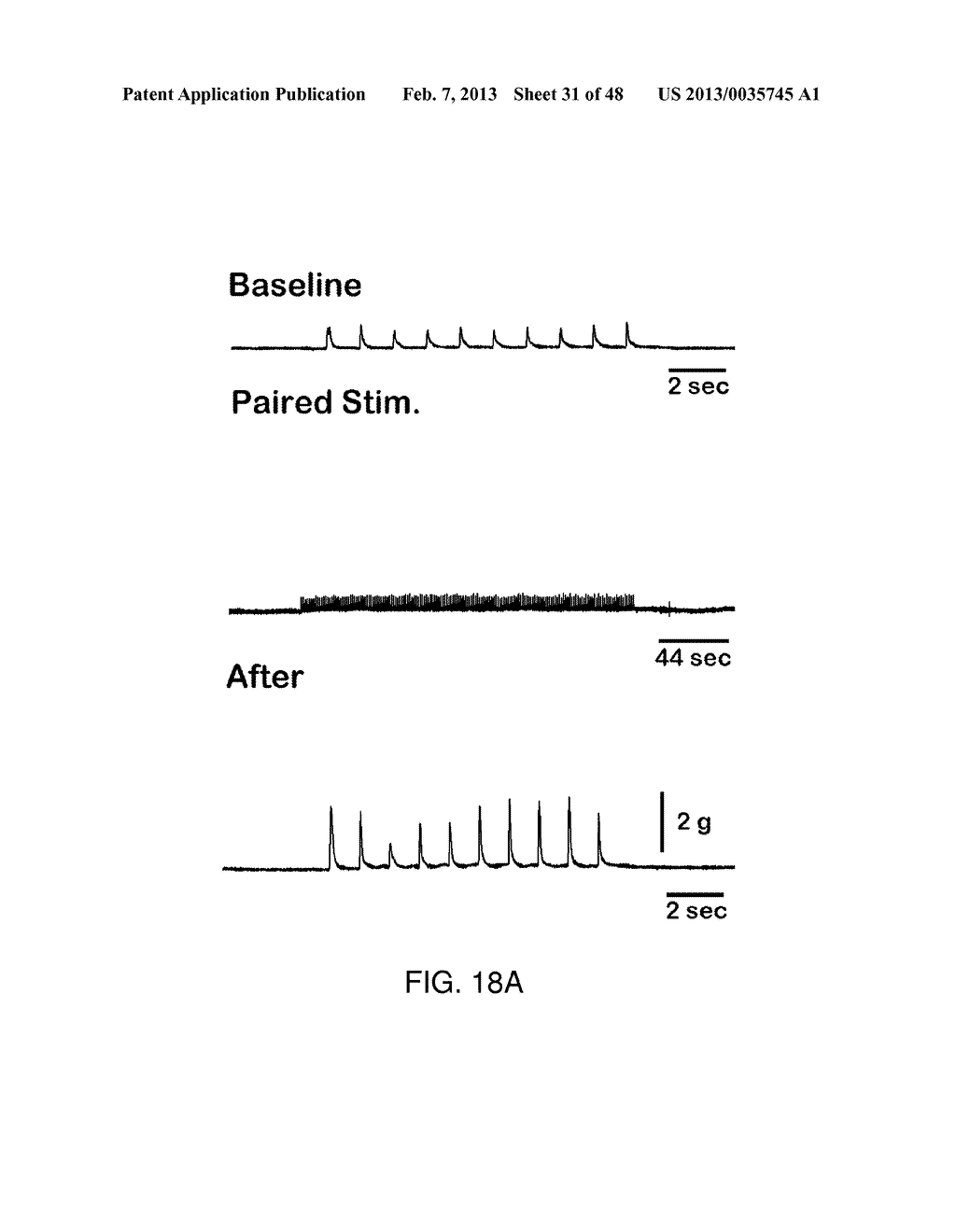 CHARGE-ENHANCED NEURAL ELECTRIC STIMULATION SYSTEM - diagram, schematic, and image 32