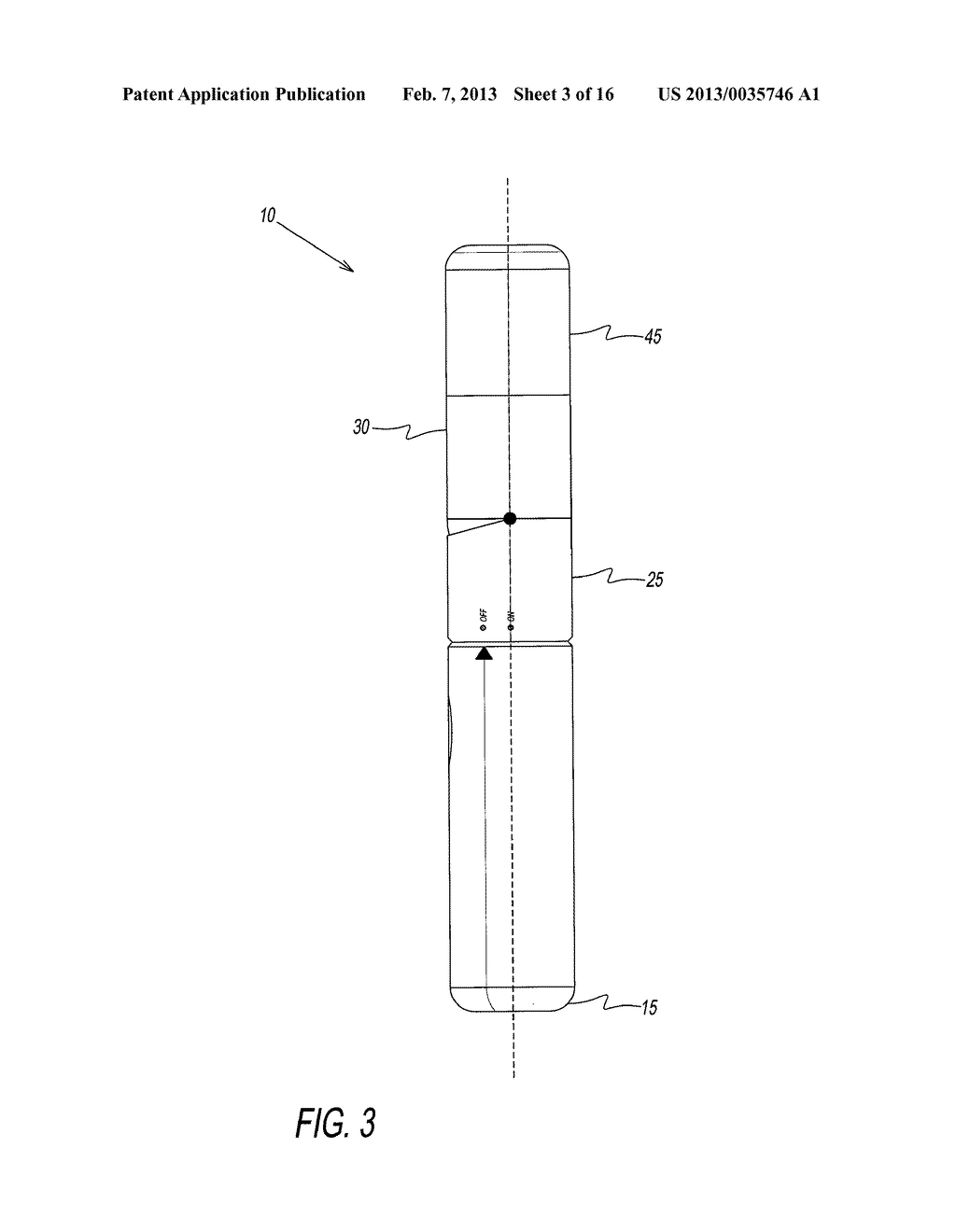 APPARATUS AND METHOD FOR TREATING RHINITIS - diagram, schematic, and image 04