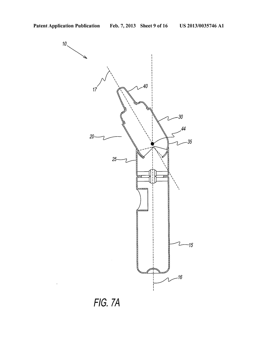 APPARATUS AND METHOD FOR TREATING RHINITIS - diagram, schematic, and image 10