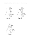 DELIVERY DEVICE HAVING A VARIABLE DIAMETER INTRODUCER SHEATH diagram and image