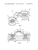 Apparatus for Treating a Heart Valve, In Particular a Mitral Valve diagram and image