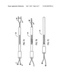 Apparatus for Treating a Heart Valve, In Particular a Mitral Valve diagram and image