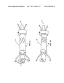 Apparatus for Treating a Heart Valve, In Particular a Mitral Valve diagram and image