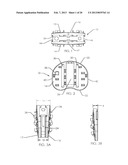 SPINAL FUSION DEVICE diagram and image