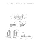 SPINAL FUSION DEVICE diagram and image