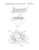 SPINAL FUSION DEVICE diagram and image