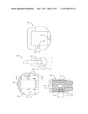 SPINAL FUSION DEVICE diagram and image