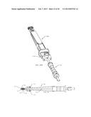 SPINAL FUSION DEVICE diagram and image