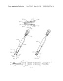 SPINAL FUSION DEVICE diagram and image