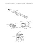 SPINAL FUSION DEVICE diagram and image