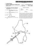 SUBCHONDRAL TREATMENT TO PREVENT THE PROGRESSION OF OSTEOARTHRITIS OF THE     JOINT diagram and image