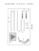 SUBCHONDRAL TREATMENT TO PREVENT THE PROGRESSION OF OSTEOARTHRITIS OF THE     JOINT diagram and image