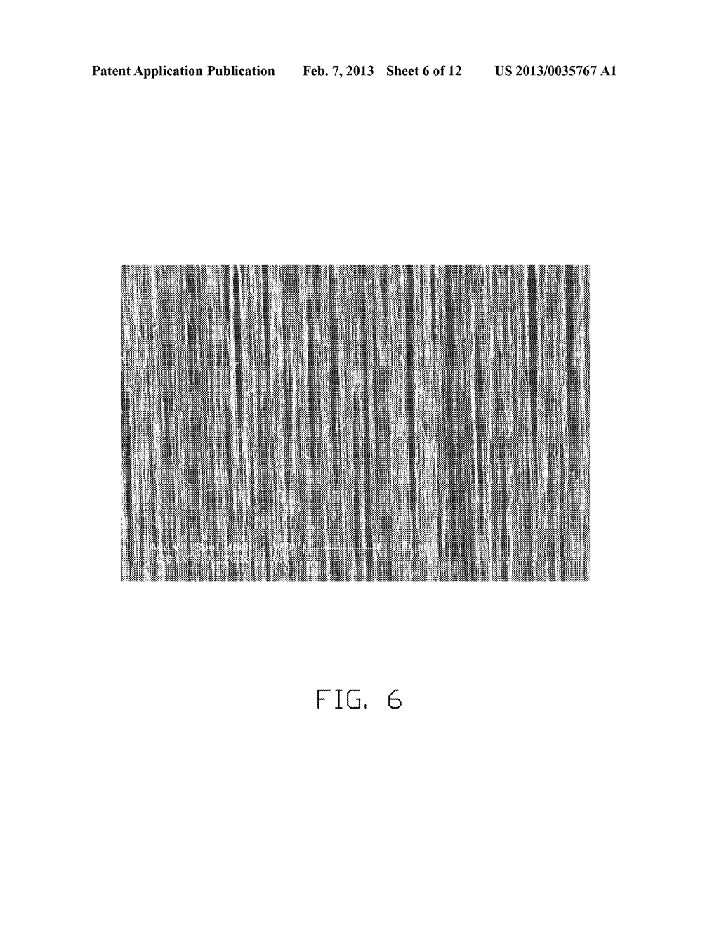 NEURAL GRAFT - diagram, schematic, and image 07