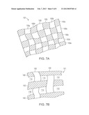 VARIABLE DENSITY TISSUE GRAFT COMPOSITION diagram and image