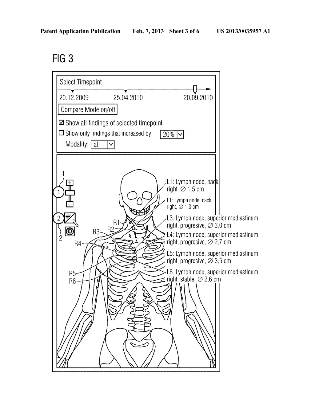 METHOD AND ARRANGEMENT FOR COMPUTER-ASSISTED REPRESENTATION AND/OR     EVALUATION OF MEDICAL EXAMINATION DATA - diagram, schematic, and image 04