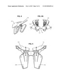 Apparatus to be worn on an individual s chest below a full face helmet to     limit the occurrence of cervical spinal cord injuries in the event of a     crash diagram and image