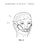 PATIENT INTERFACE DEVICE WITH CHEEKBONE STABILIZATION diagram and image