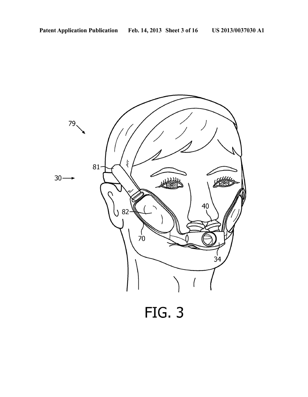 PATIENT INTERFACE DEVICE WITH CHEEKBONE STABILIZATION - diagram, schematic, and image 04