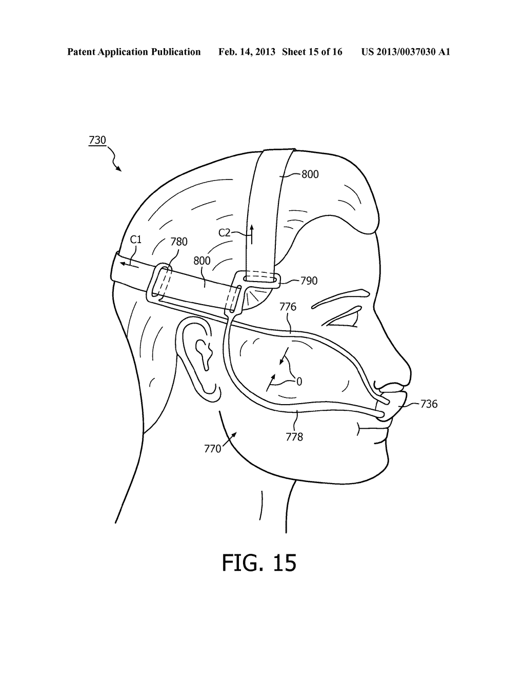 PATIENT INTERFACE DEVICE WITH CHEEKBONE STABILIZATION - diagram, schematic, and image 16