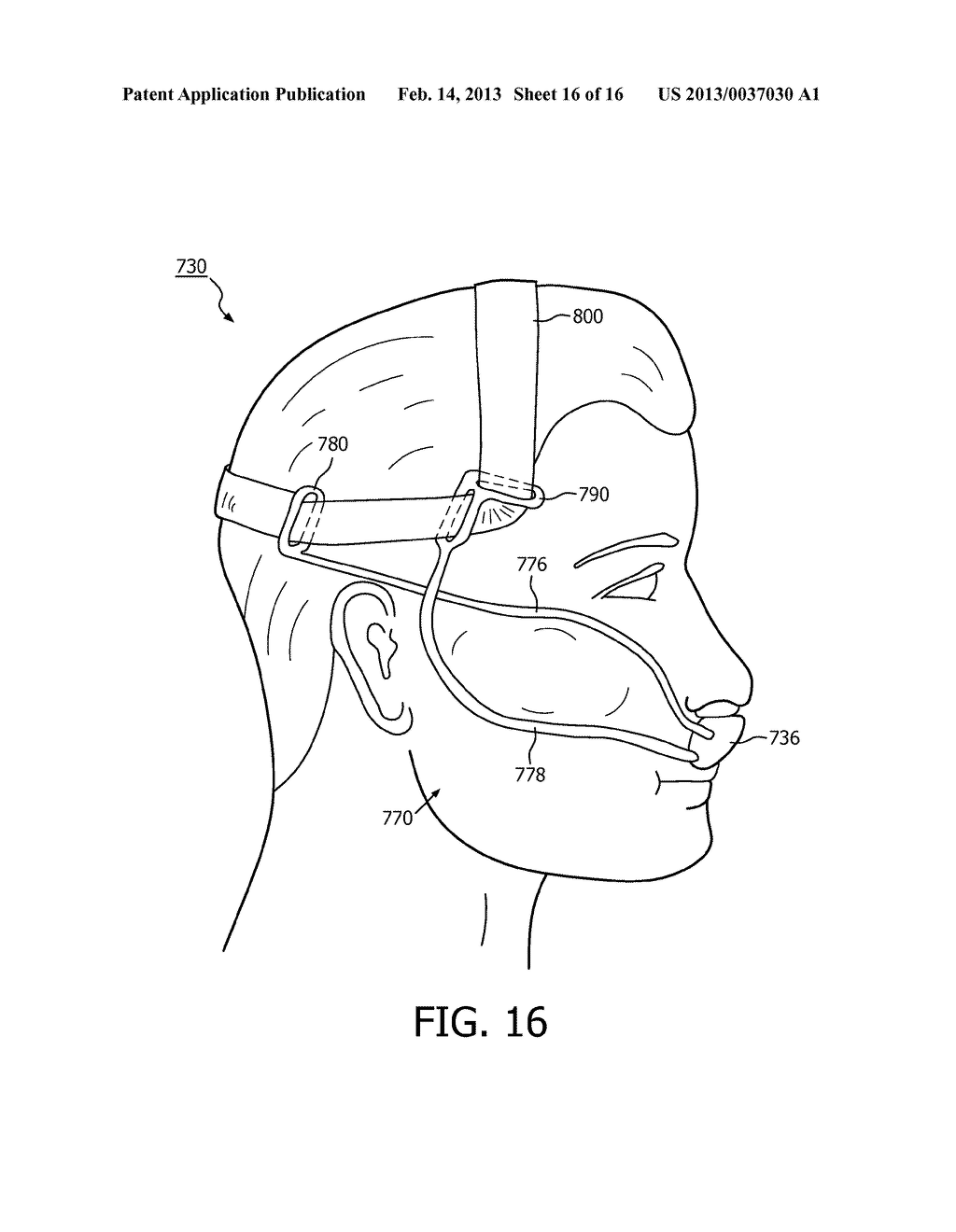 PATIENT INTERFACE DEVICE WITH CHEEKBONE STABILIZATION - diagram, schematic, and image 17