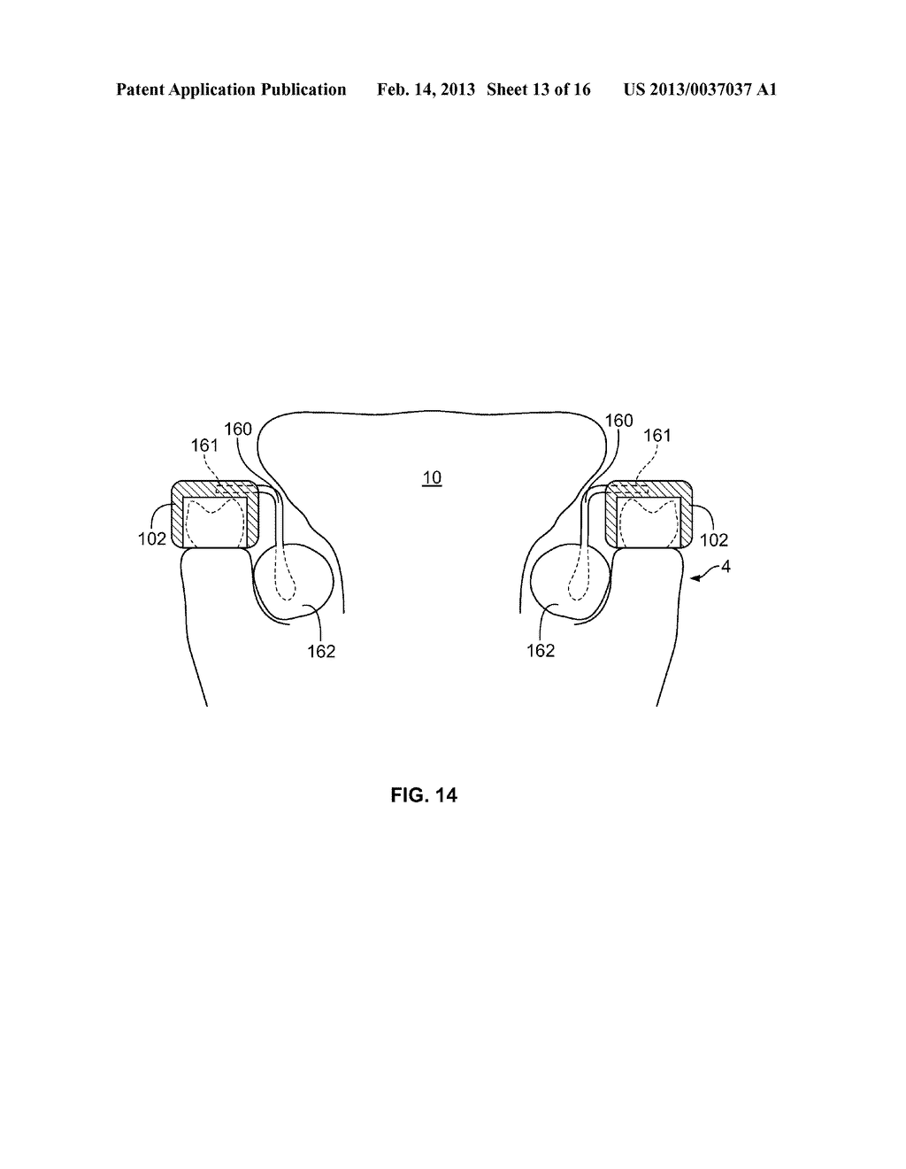 DENTAL APPLIANCE WITH ADJUSTABLE TONGUE REPOSITIONER - diagram, schematic, and image 14