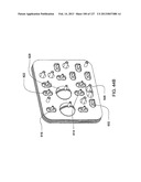 HEMODIALYSIS SYSTEMS AND METHODS diagram and image