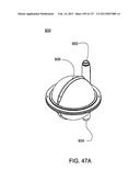 HEMODIALYSIS SYSTEMS AND METHODS diagram and image