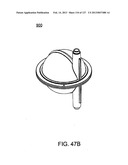 HEMODIALYSIS SYSTEMS AND METHODS diagram and image