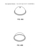 HEMODIALYSIS SYSTEMS AND METHODS diagram and image