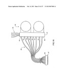 HEMODIALYSIS SYSTEMS AND METHODS diagram and image