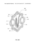 HEMODIALYSIS SYSTEMS AND METHODS diagram and image