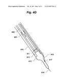 Devices and methods for cryo lift-out with in situ probe diagram and image