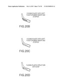 FLEXIBLE BACK SUPPORT MEMBER WITH INTEGRATED RECLINE STOP NOTCHES diagram and image