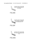 FLEXIBLE BACK SUPPORT MEMBER WITH INTEGRATED RECLINE STOP NOTCHES diagram and image