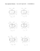 Thermally Conductive Stripline RF Transmission Cable diagram and image