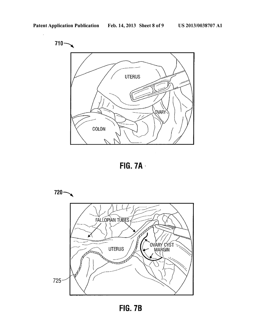 Apparatus and Method for Using Augmented Reality Vision System in Surgical     Procedures - diagram, schematic, and image 09