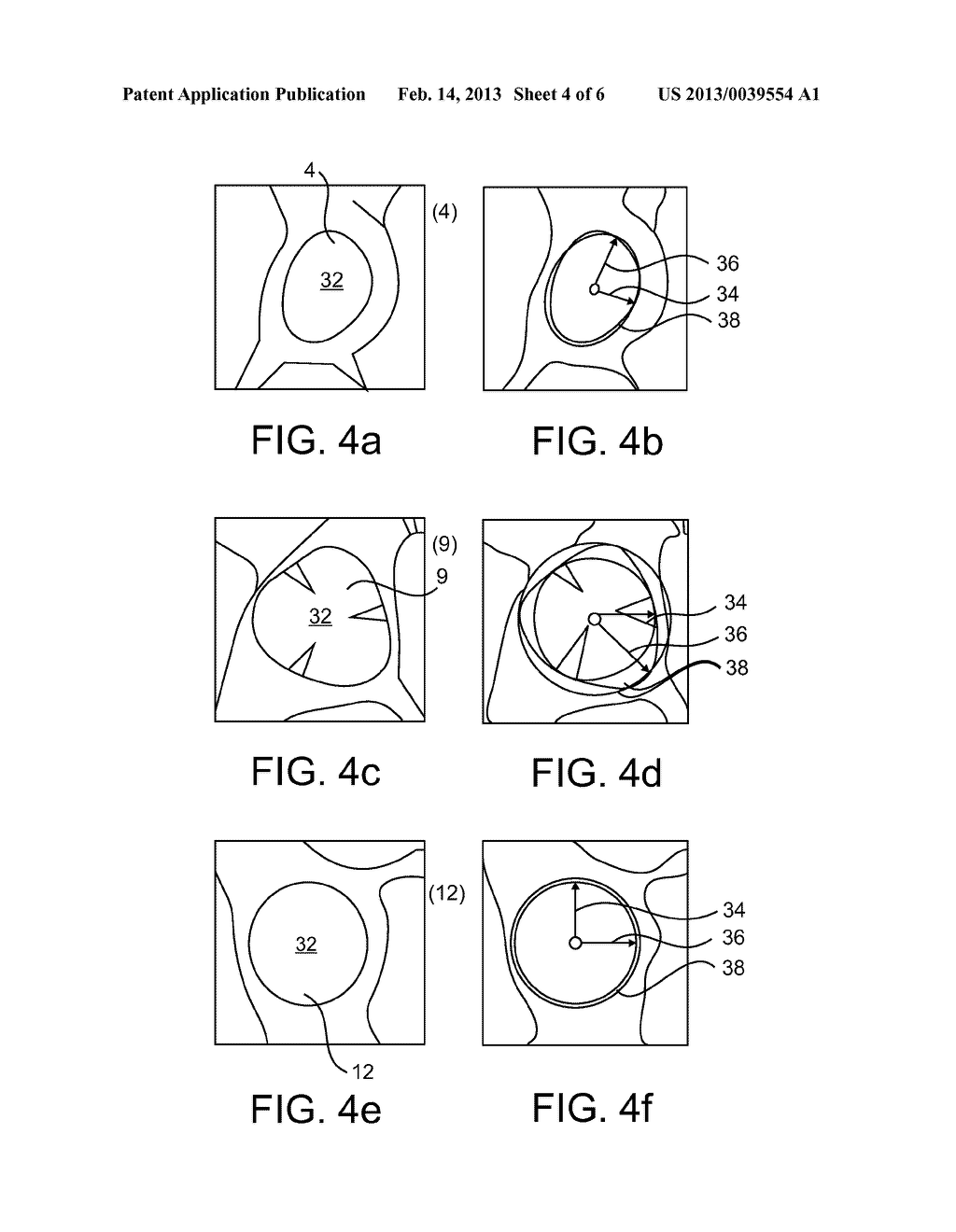 METHOD FOR DETERMINING A PHYSICAL PROPERTY OF AN OBJECT, SYSTEM, COMPUTER     READABLE MEDIUM AND PROGRAM ELEMENT - diagram, schematic, and image 05