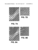 METHODS FOR THE COMPENSATION OF IMAGING TECHNIQUE IN THE PROCESSING OF     RADIOGRAPHIC IMAGES diagram and image