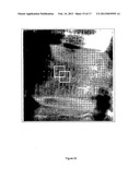 METHODS FOR THE COMPENSATION OF IMAGING TECHNIQUE IN THE PROCESSING OF     RADIOGRAPHIC IMAGES diagram and image