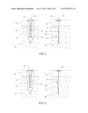 Anchor Nail diagram and image