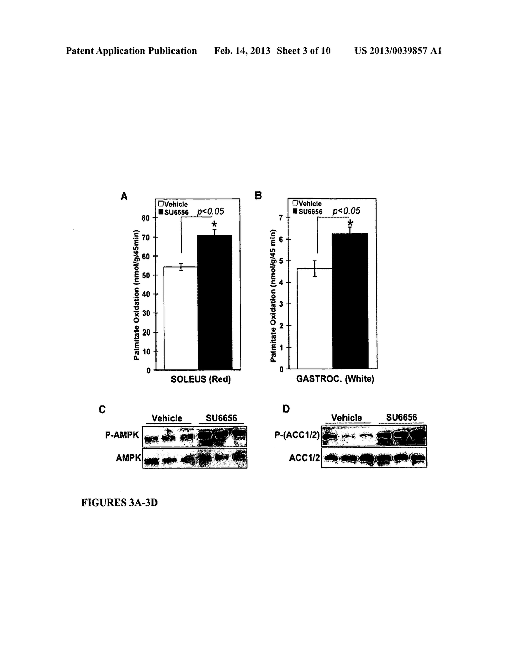 METHODS OF SUPPRESSING CANCER, INCREASING WEIGHT LOSS AND/OR INCREASING     INSULIN SENSITIVITY - diagram, schematic, and image 04