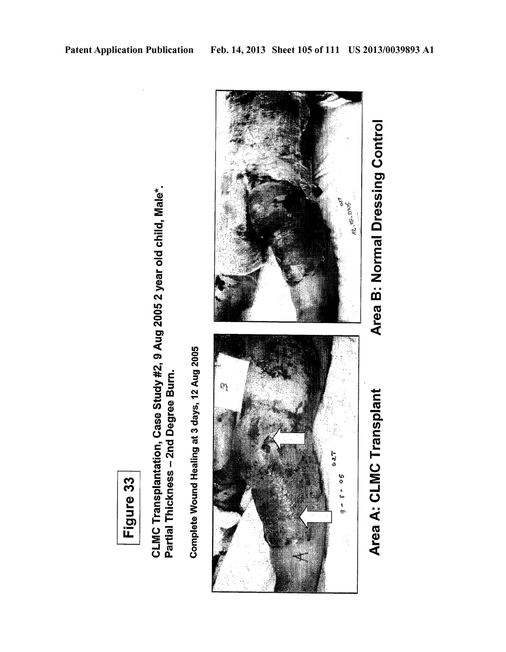 ISOLATION AND CULTIVATION OF STEM/PROGENITOR CELLS FROM THE AMNIOTIC     MEMBRANE OF UMBILICAL CORD AND USES OF CELLS DIFFERENTIATED THEREFROM - diagram, schematic, and image 106