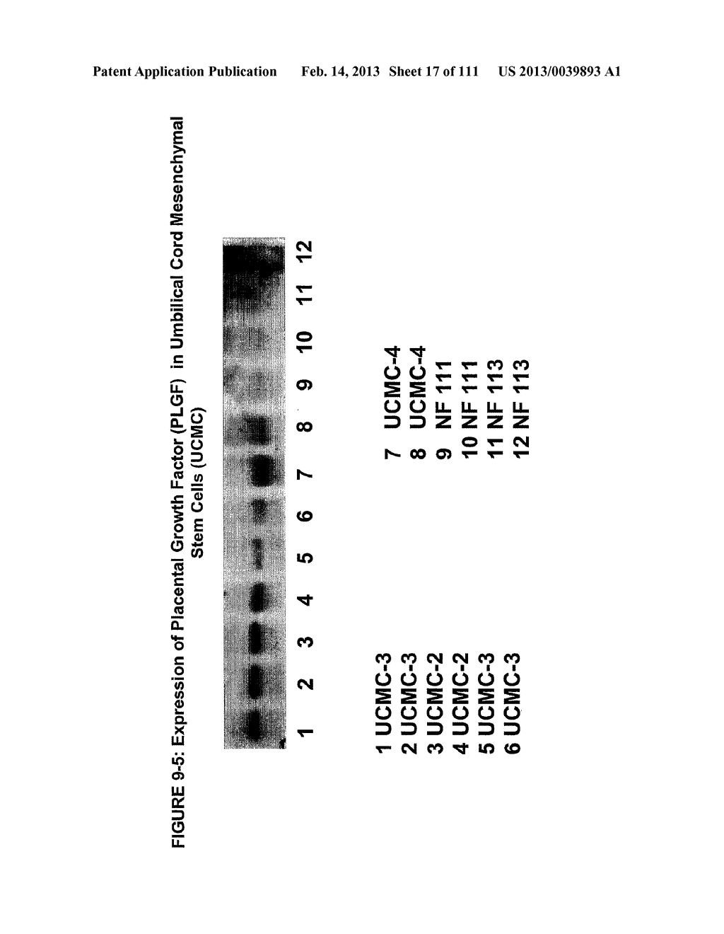 ISOLATION AND CULTIVATION OF STEM/PROGENITOR CELLS FROM THE AMNIOTIC     MEMBRANE OF UMBILICAL CORD AND USES OF CELLS DIFFERENTIATED THEREFROM - diagram, schematic, and image 18