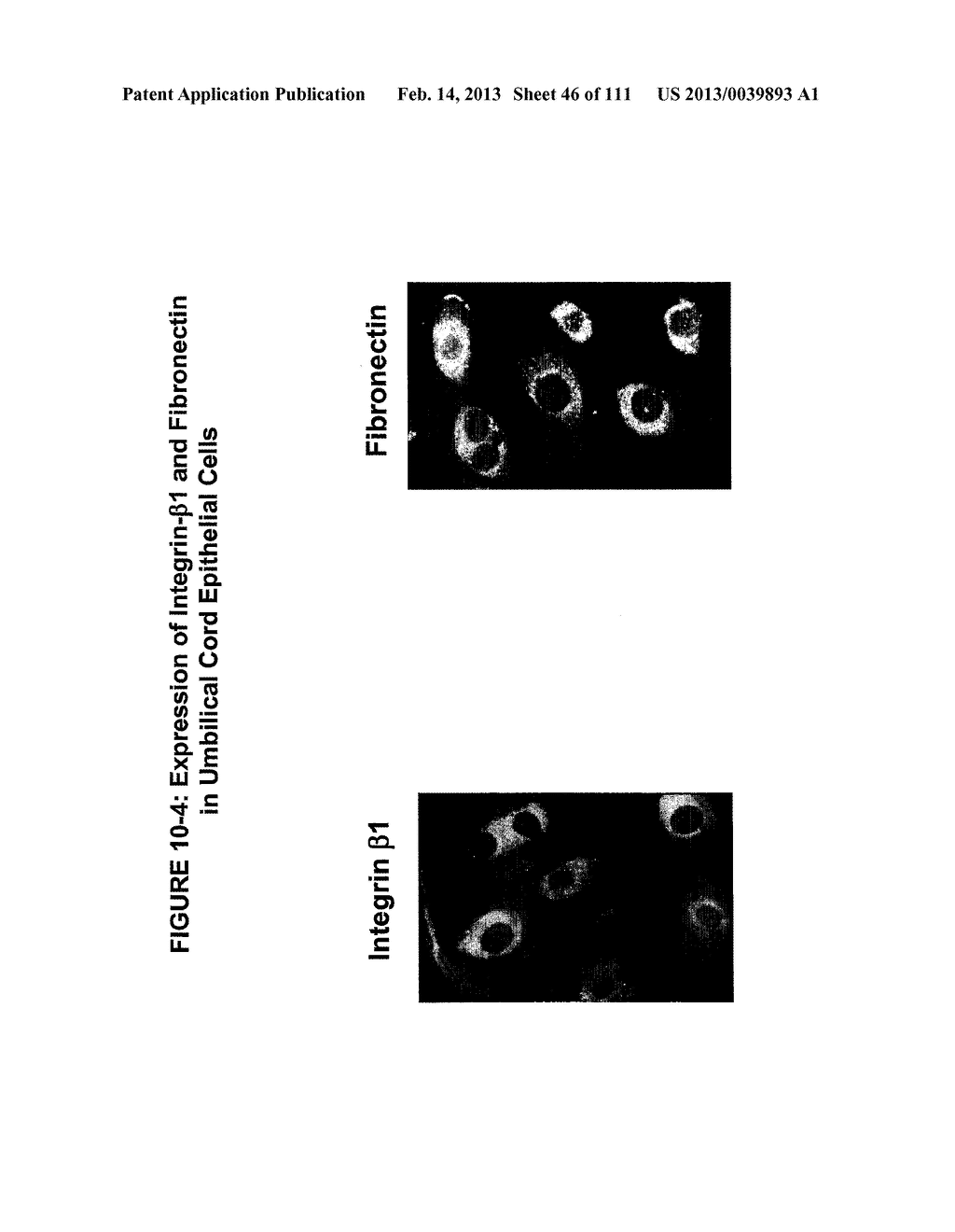 ISOLATION AND CULTIVATION OF STEM/PROGENITOR CELLS FROM THE AMNIOTIC     MEMBRANE OF UMBILICAL CORD AND USES OF CELLS DIFFERENTIATED THEREFROM - diagram, schematic, and image 47